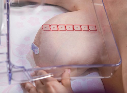 compressed breast on a Bella Blanket during mammogram