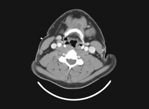 Localizers for diagnostic CT, in use