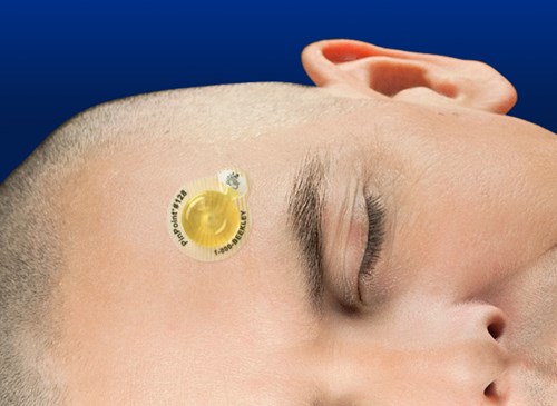 PinPoint 128 adhered to patient's forehead
