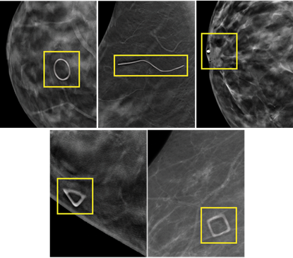 Beekley Skin Marking System® x-rays highlighting the 5 shapes