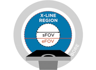 X-Line diagram of extended field of view