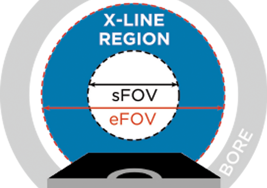 X-Line eFOV diagram